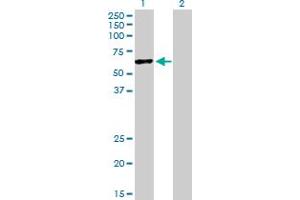 Western Blot analysis of HERPUD1 expression in transfected 293T cell line by HERPUD1 MaxPab polyclonal antibody. (HERPUD1 抗体  (AA 1-391))