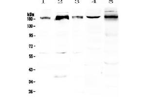 Western blot analysis of PER1 using anti-PER1 antibody .