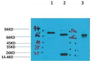 Western Blot (WB) analysis of 1) Rat Brain Tissue, 2)Mouse Brain Tissue, 3) HepG2 with KCNN2(SK2) Rabbit Polyclonal Antibody diluted at 1:2000. (KCNN2 抗体)