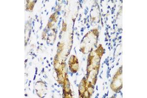 Immunohistochemistry of paraffin-embedded human gastric using NAA60 antibody (ABIN5975517) at dilution of 1/200 (40x lens). (NAT15 抗体)