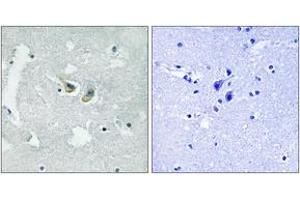 Immunohistochemistry analysis of paraffin-embedded human brain, using p47 phox (Phospho-Ser345) Antibody. (NCF1 抗体  (pSer345))