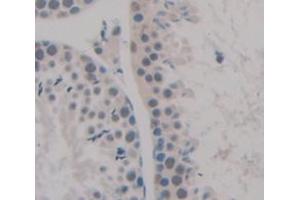 Used in DAB staining on fromalin fixed paraffin- embedded Kidney tissue (NEK2 抗体  (AA 125-393))