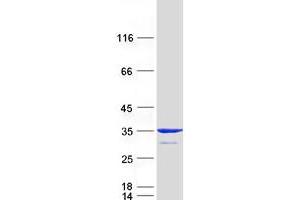 Western Blotting (WB) image for MIT, Microtubule Interacting and Transport, Domain Containing 1 (MITD1) protein (Myc-DYKDDDDK Tag) (ABIN2726066)
