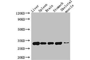 Western Blot Positive WB detected in: Mouse liver tissue, Mouse spleen tissue, Mouse brain tissue, Mouse stomach tissue, Mouse skeletal muscle tissue All lanes: GPM6A antibody at 4 μg/mL Secondary Goat polyclonal to rabbit IgG at 1/50000 dilution Predicted band size: 32, 31, 30 kDa Observed band size: 32 kDa (GPM6A 抗体  (AA 149-213))