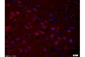 Formalin-fixed and paraffin embedded rat brain tissue labeled with Anti- phospho-PRKC Polyclonal Antibody, Unconjugated (ABIN741240) at 1:200 followed by conjugation to the secondary antibody Goat Anti-Rabbit IgG, PE conjugated used at 1:200 dilution for 40 minutes at 37°C and DAPI (PKC beta 抗体  (pThr500))