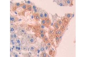 Used in DAB staining on fromalin fixed paraffin- embedded liver tissue (CRYBB1 抗体  (AA 6-186))