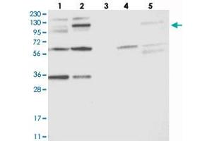 Western blot analysis of Lane 1: RT-4, Lane 2: U-251 MG, Lane 3: Human Plasma, Lane 4: Liver, Lane 5: Tonsil with OSBP2 polyclonal antibody . (OSBP2 抗体)