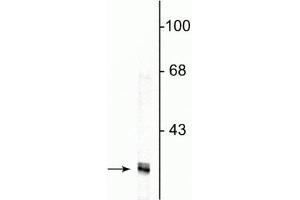 Western blot of HeLa cell lysate showing specific immunolabeling of the ~34 kDa fibrillarin protein. (Fibrillarin 抗体)