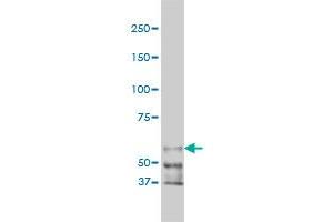 PAK1 monoclonal antibody (M02), clone 4D1 Western Blot analysis of PAK1 expression in HeLa NE (PAK1 抗体  (AA 191-280))