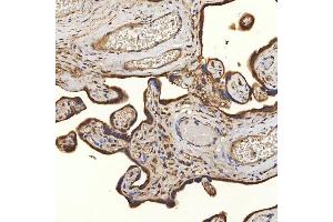 IHC analysis of SLC25A24 using anti-SLC25A24 antibody (ABIN7599228).