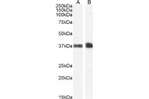 ABIN185486 (1 μg/mL) staining of Human Peripheral Blood Monocytes (A) and Kidney (B) lysate (35 μg protein in RIPA buffer). (CD235a/GYPA 抗体  (C-Term))