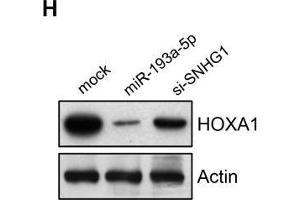 SNHG1 acts as a sponge of miR-193a-5p to activate HOXA1 expression. (HOXA1 抗体  (AA 75-205))
