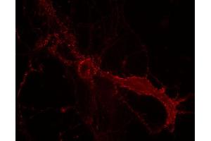 Indirect immunostaining of PFA fixed rat hippocampus neurons (dilution 1 : 100). (DLG3 抗体)