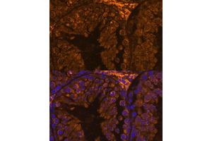 Immunofluorescence (IF) image for anti-Zona Pellucida Binding Protein (ZPBP) (AA 45-200) antibody (ABIN7271569)