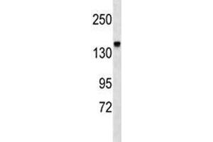 Integrin alpha 2 antibody western blot analysis in mouse kidney tissue lysate (ITGA2 抗体  (AA 1152-1180))
