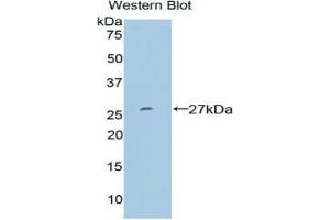 Western blot analysis of the recombinant protein. (SP100 抗体  (AA 261-465))