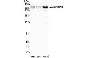 Western Blotting (WB) image for anti-Spectrin Beta, Non-Erythrocytic 1 (SPTBN1) (AA 2100-2150) antibody (ABIN7454694) (SPTBN1 抗体  (AA 2100-2150))