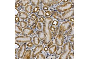 Immunohistochemistry (IHC) image for anti-Signal Transducer and Activator of Transcription 3 (Acute-Phase Response Factor) (STAT3) (AA 640-770) antibody (ABIN6148568)