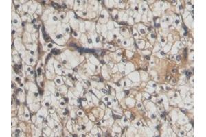Immunohistochemistry (IHC) image for anti-Connective Tissue Growth Factor (CTGF) (AA 80-200) antibody (ABIN7437947)