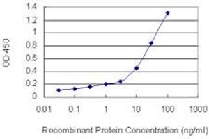 Detection limit for recombinant GST tagged PNN is 0. (PNN 抗体  (AA 201-300))