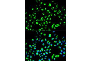 Immunofluorescence analysis of HeLa cells using YWHAQ antibody (ABIN5971388). (14-3-3 theta 抗体)