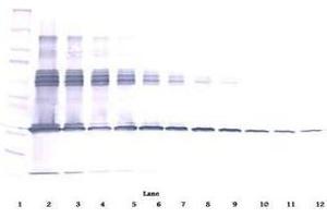 Image no. 2 for anti-Colony Stimulating Factor 1 (Macrophage) (CSF1) antibody (ABIN465551) (M-CSF/CSF1 抗体)