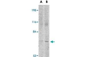 Western blot analysis of JPH1 in 293 cell lysate with JPH1 polyclonal antibody  at (A) 1 and (B) 2 ug/mL . (Junctophilin 1 抗体  (C-Term))