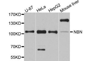 Western blot analysis of extracts of various cell lines, using NBN antibody. (Nibrin 抗体)
