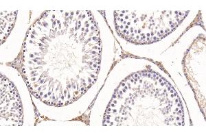 Detection of KNT1 in Rat Testis Tissue using Monoclonal Antibody to T-Kininogen 1 (KNT1) (KNG1 抗体  (AA 378-430))