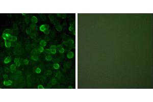 Peptide - +Immunofluorescence analysis of A549 cells, using E-cadherin antibody. (E-cadherin 抗体)