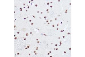 Immunohistochemistry of paraffin-embedded rat brain using S Rabbit pAb (ABIN6132631, ABIN6147390, ABIN6147391 and ABIN6224669) at dilution of 1:100 (40x lens).
