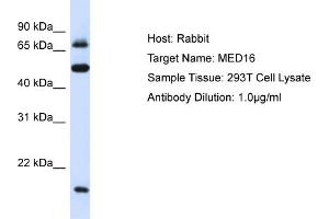 Host: Rabbit Target Name: MED16 Sample Type: 293T Whole Cell lysates Antibody Dilution: 1. (MED16 抗体  (Middle Region))
