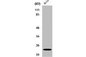 Western Blot analysis of Jurkat cells using CRP1 Polyclonal Antibody (CSRP1 抗体  (Internal Region))