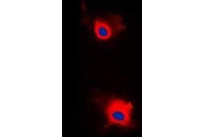Immunofluorescent analysis of IRS1 (pS636) staining in MCF7 cells. (IRS1 抗体  (pSer636))
