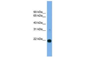 WB Suggested Anti-MITD1 Antibody Titration: 0. (MITD1 抗体  (Middle Region))