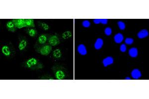 Immunofluorescence analysis of HUVEC cells using Phospho-JNK1/2/3-T183/T183/T221 antibody (abx125450). (SMAD2 抗体  (pThr183, pThr221))
