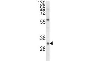 Western blot analysis of GDNF antibody and mouse NIH3T3 lysate. (GDNF 抗体  (AA 8-36))