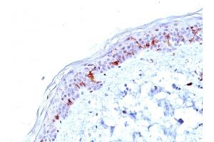 Formalin-fixed, paraffin-embedded human Skin stained with CD1a Mouse Monoclonal Antibody (O10). (CD1a 抗体)