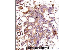 Immunohistochemistry (Paraffin-embedded Sections) (IHC (p)) image for anti-Catenin (Cadherin-Associated Protein), beta 1, 88kDa (CTNNB1) (AA 692-721), (C-Term) antibody (ABIN1881238)