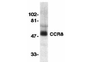 Western Blotting (WB) image for anti-Chemokine (C-C Motif) Receptor 8 (CCR8) (Extracellular Loop) antibody (ABIN1030839) (CCR8 抗体  (Extracellular Loop))