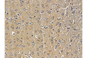 ABIN6258288 and ABIN6275675 at 1/100 staining rat brain tissue by IHC-P. (NSF 抗体  (Internal Region))