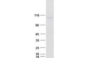 Western Blotting (WB) image for DEAD (Asp-Glu-Ala-Asp) Box Polypeptide 20 (DDX20) protein (Myc-DYKDDDDK Tag) (ABIN2719278)