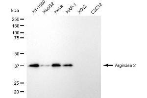 Western blotting analysis using arginase 2 antibody (ABIN7797645). (ARG2 抗体)