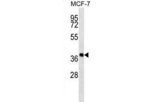 Western Blotting (WB) image for anti-Dehydrogenase/reductase (SDR Family) Member 7B (DHRS7B) antibody (ABIN2997289) (DHRS7B 抗体)