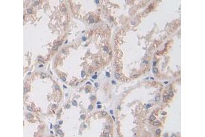 Used in DAB staining on fromalin fixed paraffin- embedded kidney tissue (BPGM 抗体  (AA 29-242))