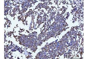 IHC analysis of Beclin 1 using anti-Beclin 1 antibody (ABIN7599303).