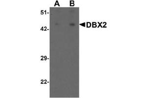 Western blot analysis of DBX2 in human kidney tissue lysate with DBX2 antibody at (A) 1 and (B) 2 ug/mL. (DBX2 抗体  (N-Term))