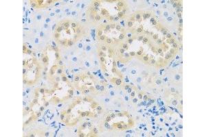 Immunohistochemistry of paraffin-embedded Rat kidney using LETMD1 Polyclonal Antibody at dilution of 1:100 (40x lens). (LETMD1 抗体)