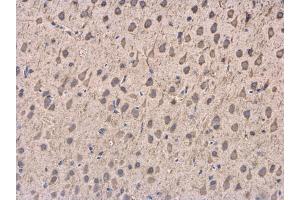Immunohistochemistry (IHC) image for anti-Dynactin 1 (DCTN1) (C-Term) antibody (ABIN2854663)