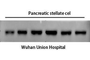 Western Blot (WB) analysis: Please contact us for more details. (alpha-SMA 抗体)